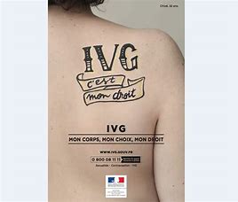 IVG